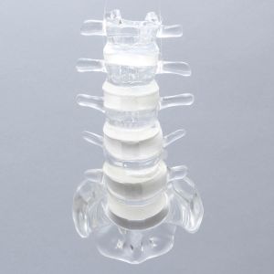 Spine with Ligaments, Lumbar, Solid Clear Plastic