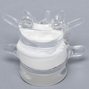 Lumbar Vertebrae L4 - L5 with White Foam Disc, Solid Clear Plastic