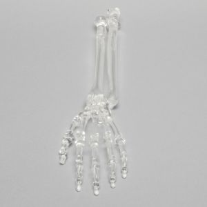 Hand and Wrist, Solid Clear Plastic