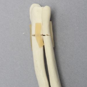 Canine Radius and Ulna with Distal Transverse Fractures, Solid Foam, Small