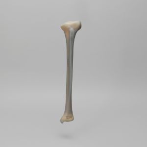 Tibia, absolute™ 4th Gen., 17 PCF, Solid Foam Core with Varus Deformity, Medium