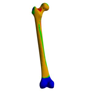 Femur, Finite Element Model of #3503