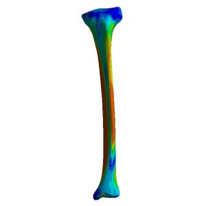 Tibia, Finite Element Model of #3402