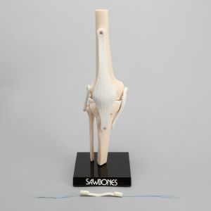 Knee ACLR Demonstrator with Removable Bone Graft