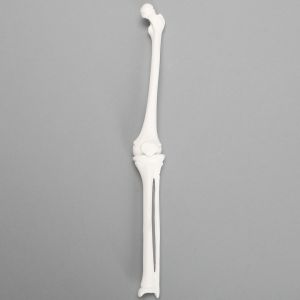 Knee, Pediatric, Solid White Plastic