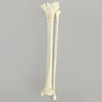 Tibia and fibula bone models aid orthopaedic trainees in visualization and technique perfection necessary in reduction and fixation procedures. Find out how a tibia and fibula bone model helps practice different fracture treatments in the link in our bio.