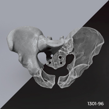 Radiopaque bone models allow the user to learn imaging techniques and identify fracture patterns.