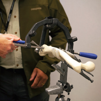 Femur bone model features should give users a thorough understanding of the treatment for common fracture patterns in this area, including open, oblique, comminuted, and transverse injuries.