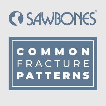 Some common #fracture patterns will require a simple setting or casting. Others are more complex, demanding surgical intervention. In either case, they must be accurately diagnosed and treated.