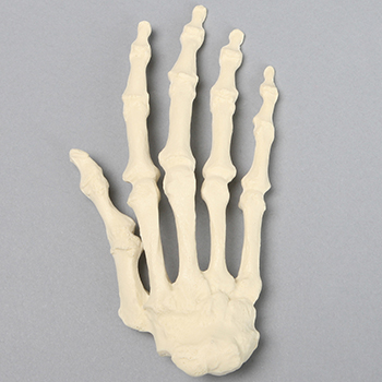 Hand models for rheumatoid arthritis help residents and patients visualize how the autoimmune disease damages the bones and joints of the hand.