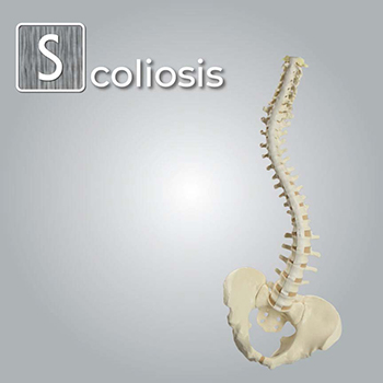 S is for Scoliosis